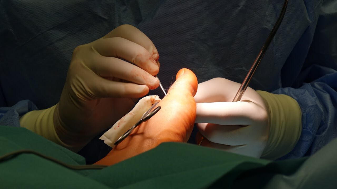 temps-pour-marcher-apres-fracture-malleole